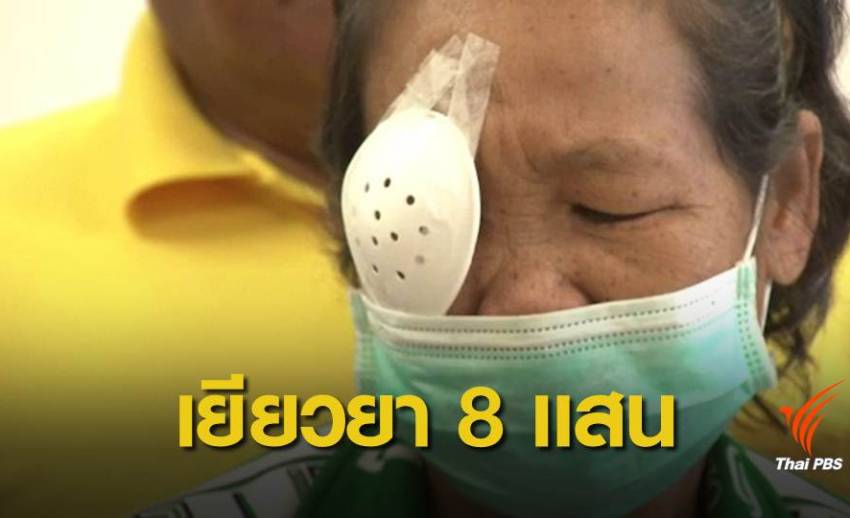 เยียวยา 8 แสนบาท ผู้เสียหายใช้น้ำสมุนไพรหยอดตาบอด
