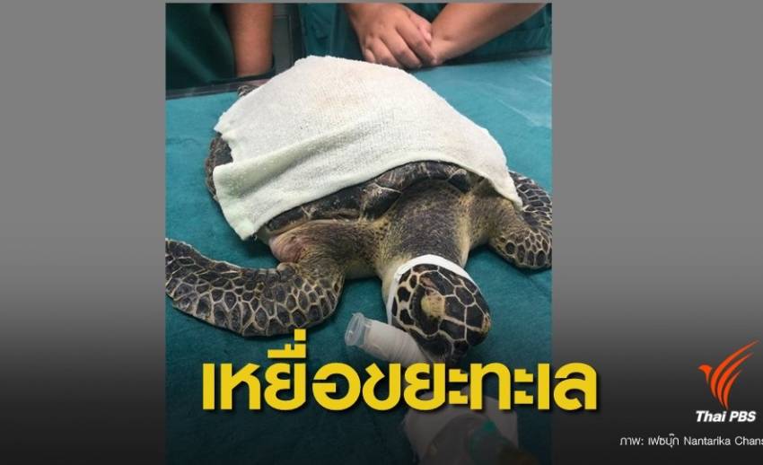 เหยื่อตัวล่าสุด ! ผ่าตัดสำเร็จ “เทรสซี่” เต่าทะเลเกยตื้นขยะเต็มท้อง