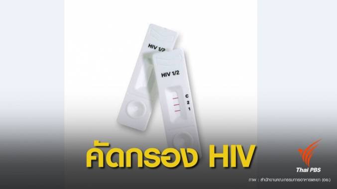 อย.ปลดล็อก "ชุดตรวจ HIV" ซื้อจากร้านขายยาตรวจเองได้