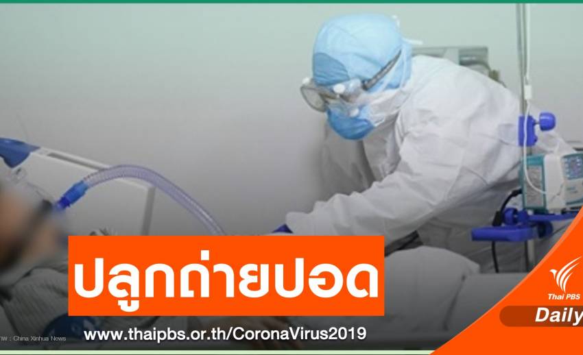 ทีมแพทย์จีนปลูกถ่ายปอด 2 ข้างให้ผู้ติดเชื้อ COVID-19 สำเร็จ
