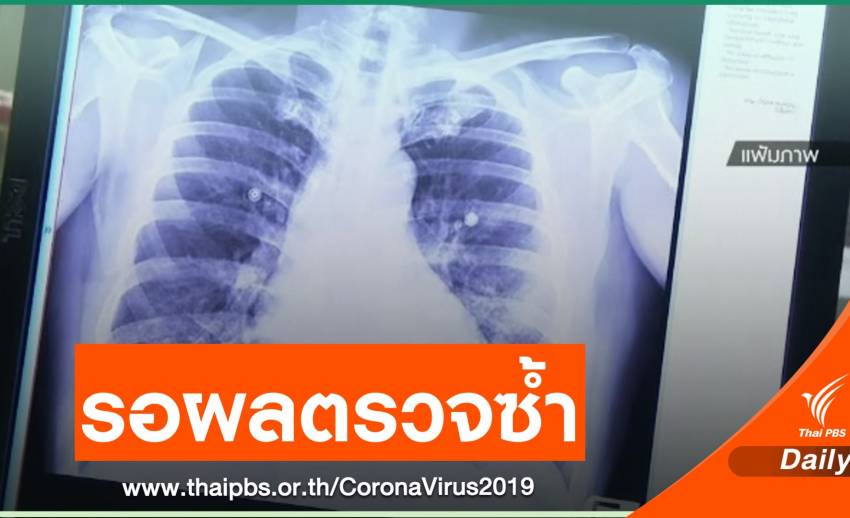 เปิดไทม์ไลน์ พนักงานร้านอาหารชาวอินเดียติด COVID-19 ในไทย ตรวจซ้ำไม่พบเชื้อ