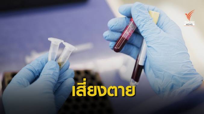 หมอเตือน "ติดเชื้อในกระแสเลือด" เสี่ยงอันตรายถึงชีวิต