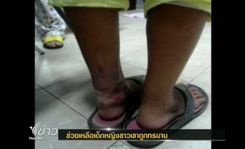 ตร.กำแพงเพชรช่วยเหลือเด็กหญิงชาวเขาถูกทรมานตั้งแต่อายุ 5 ปี