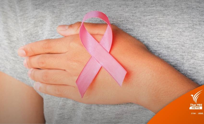 หญิงไทยป่วย “มะเร็งเต้านม” อันดับ 1 เฉลี่ยรายใหม่ 1.8 หมื่นคน 