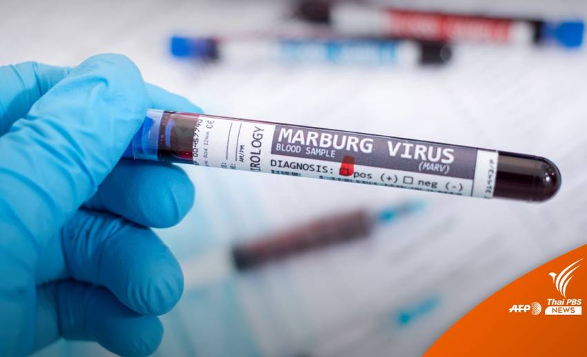 เฝ้าระวัง "ไวรัสมาร์เบิร์ก" พบผู้ติดเชื้อในแอฟริกาตะวันตก
