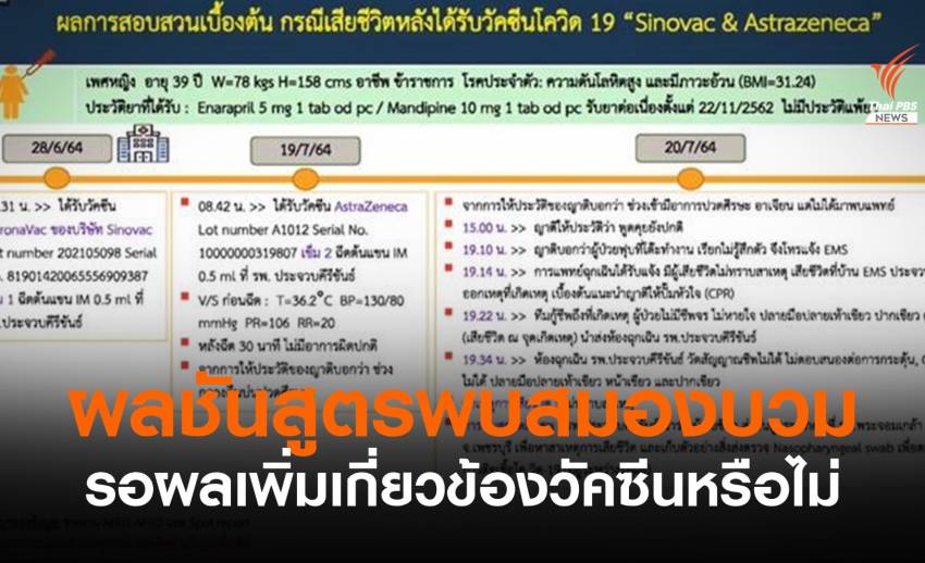 ชันสูตรหญิง 39 ปี พบสมองบวม รอผลเพิ่มว่าเกี่ยวกับวัคซีนหรือไม่