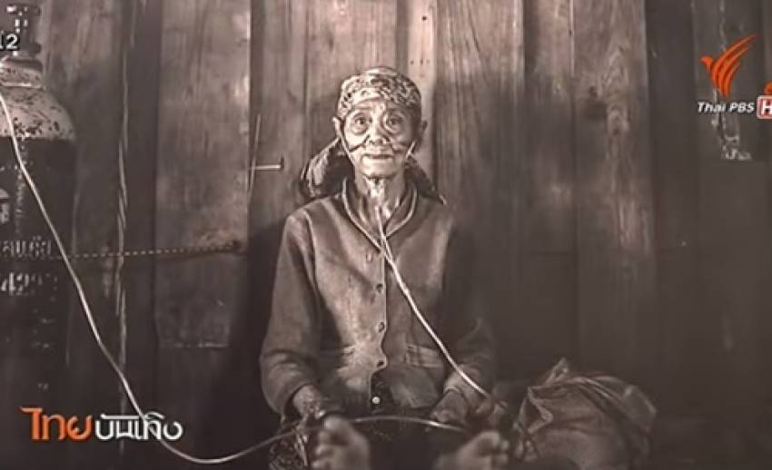 "ด้านมืดของเมือง" เล่าเรื่องชีวิตคนที่ทนทุกข์จาก "ถ่านหิน" ผ่านเลนส์ช่างภาพ
