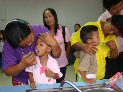 พบเด็กไทยฟันผุลดลง สปสช.ชี้ช่วยกองทุนทันตกรรมประหยัดค่ารักษากว่า 300 ล้านบาท