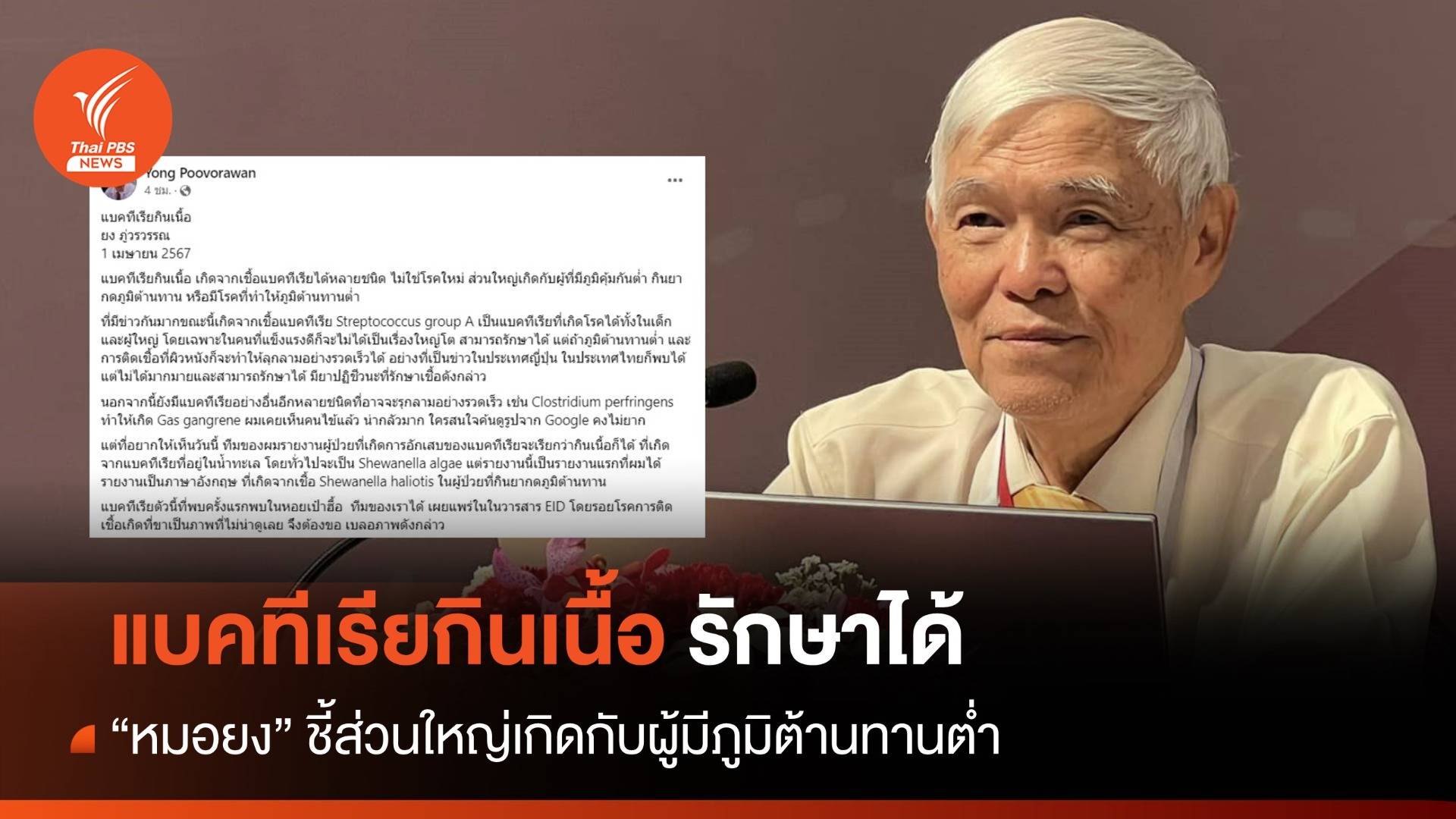 "หมอยง" ชี้แบคทีเรียกินเนื้อ รักษาได้ ส่วนใหญ่เกิดกับคนภูมิคุ้มกันต่ำ