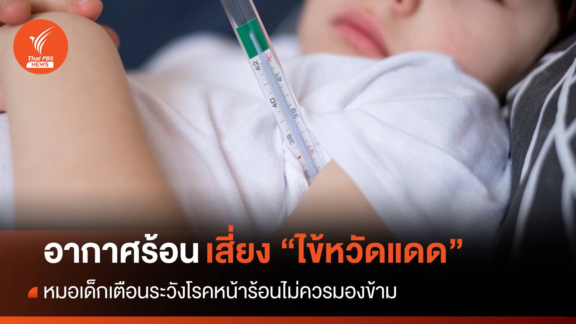 หมอเด็กเตือน "ไข้หวัดแดด" จากเชื้อไข้หวัดใหญ่ช่วงหน้าร้อน