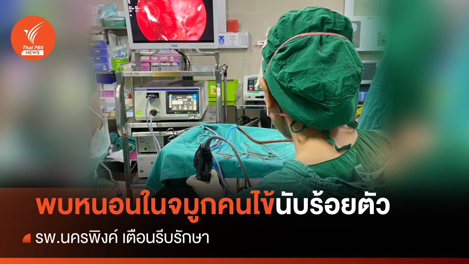 รพ.นครพิงค์ พบหนอนในจมูกคนไข้นับร้อยตัว เตือนรีบรักษา