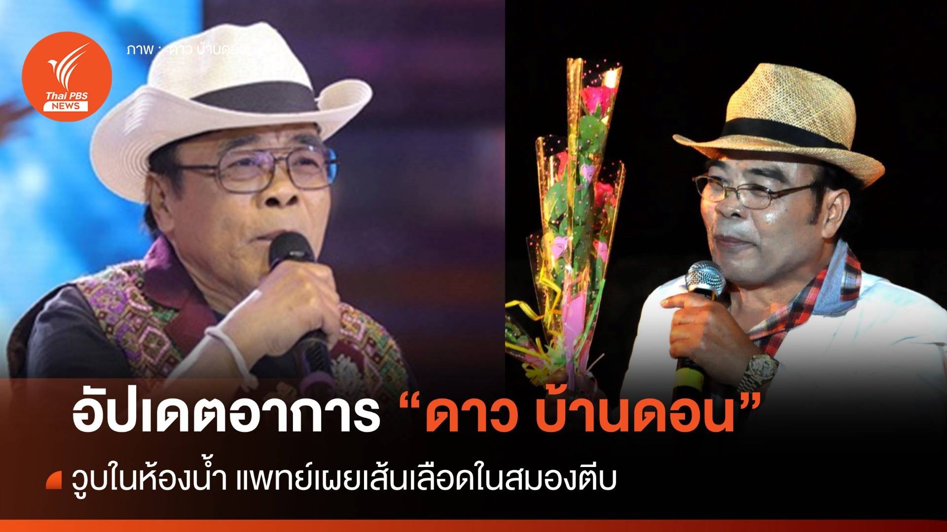 "ดาว บ้านดอน" วูบในห้องน้ำ นอน ICU หมอเผยเส้นเลือดในสมองตีบ