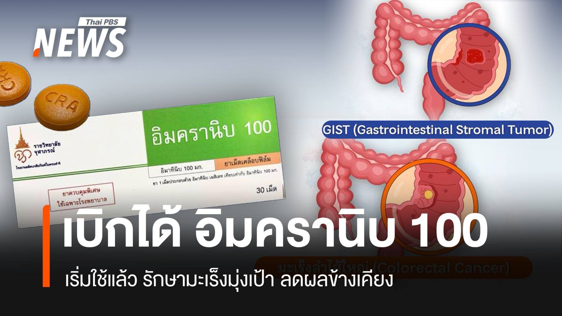 เริ่มใช้แล้ว "อิมครานิบ 100" ลดผลข้างเคียง รักษามะเร็งมุ่งเป้า 