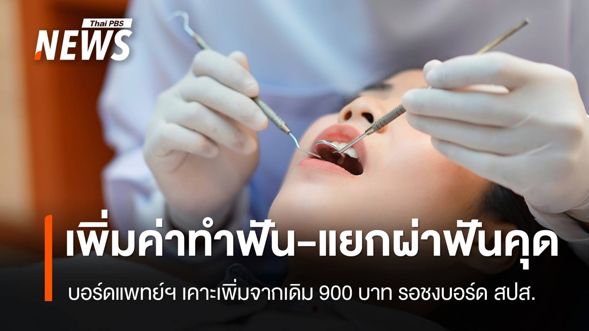 บอร์ดแพทย์ สปส.เคาะเพิ่มค่าทำฟันจากเดิม 900 บาท - แยกผ่าฟันคุด