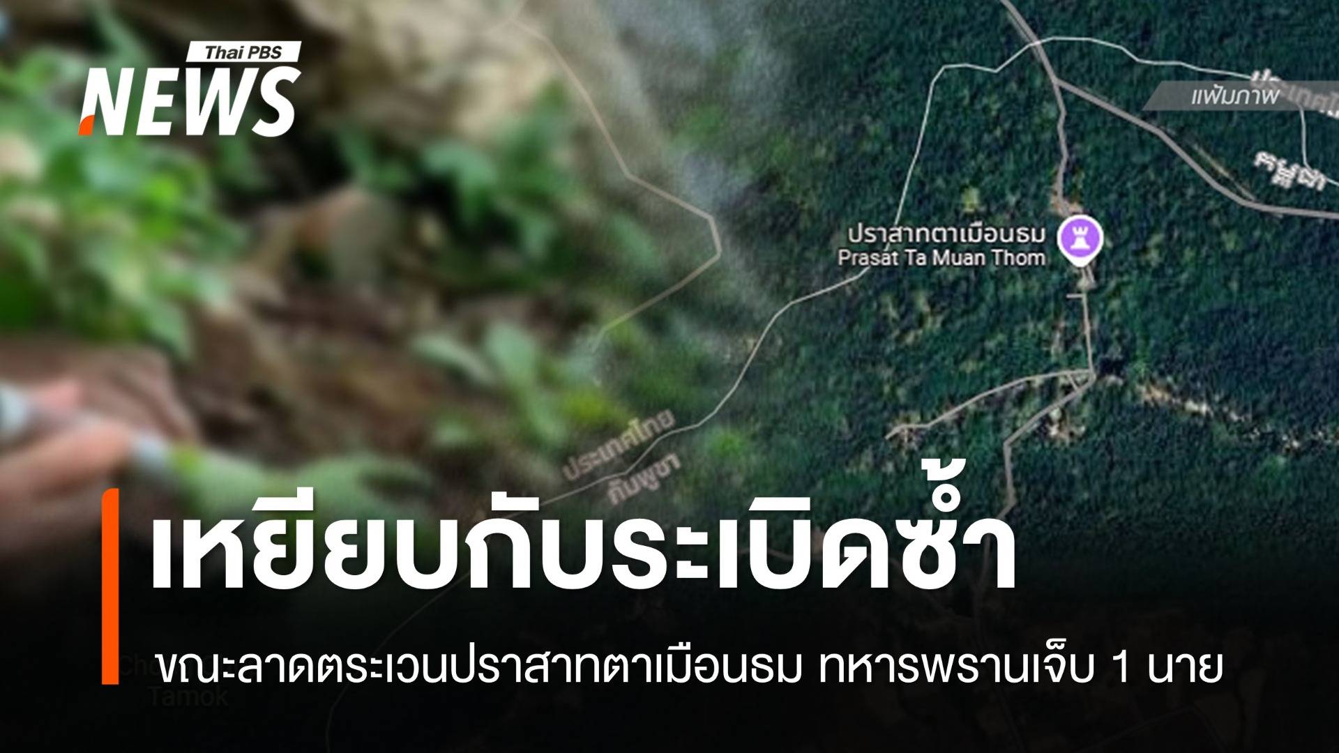 ทหารพรานเหยียบกับระเบิดขาขาด 1 นาย ลาดตระเวนปราสาทตาเมือนธม
