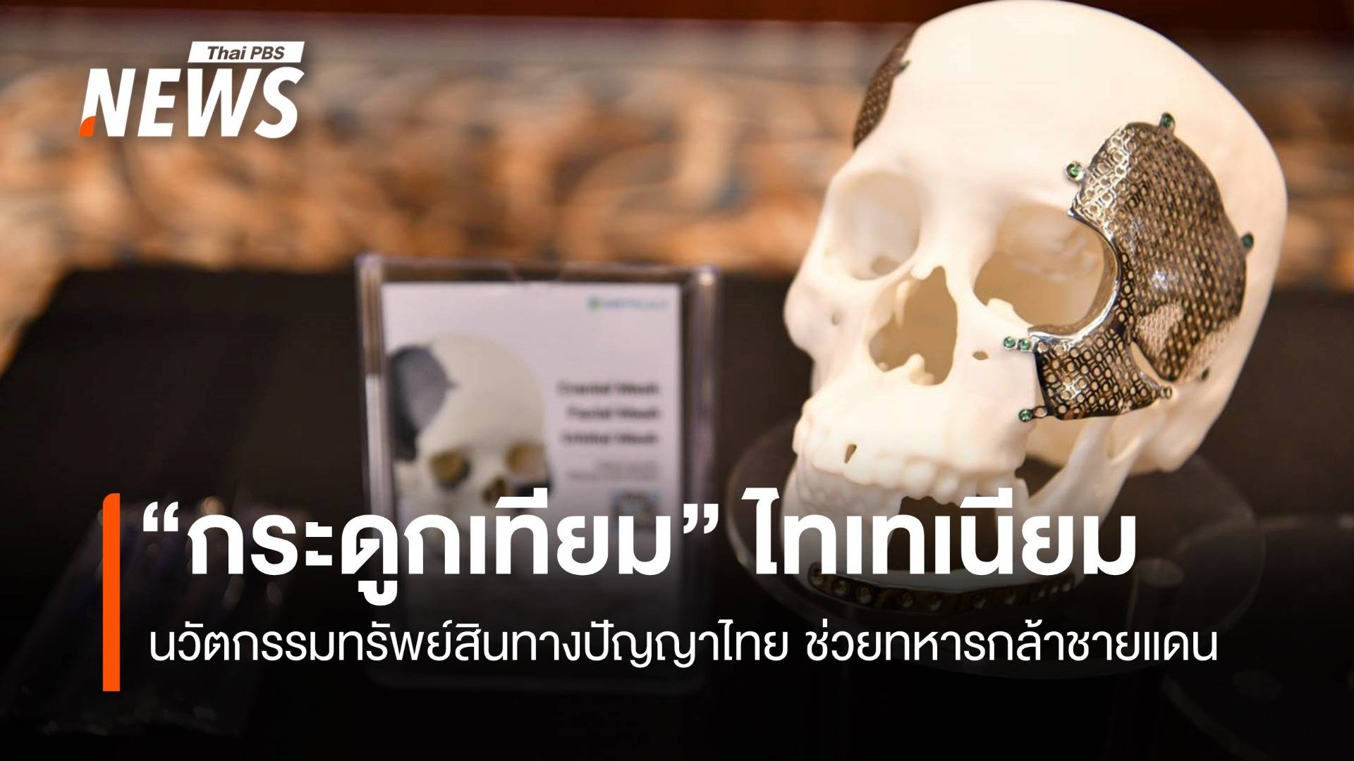 “กระดูกเทียม” ไทเทเนียม นวัตกรรมทรัพย์สินทางปัญญาไทย ช่วยทหารกล้าชายแดน