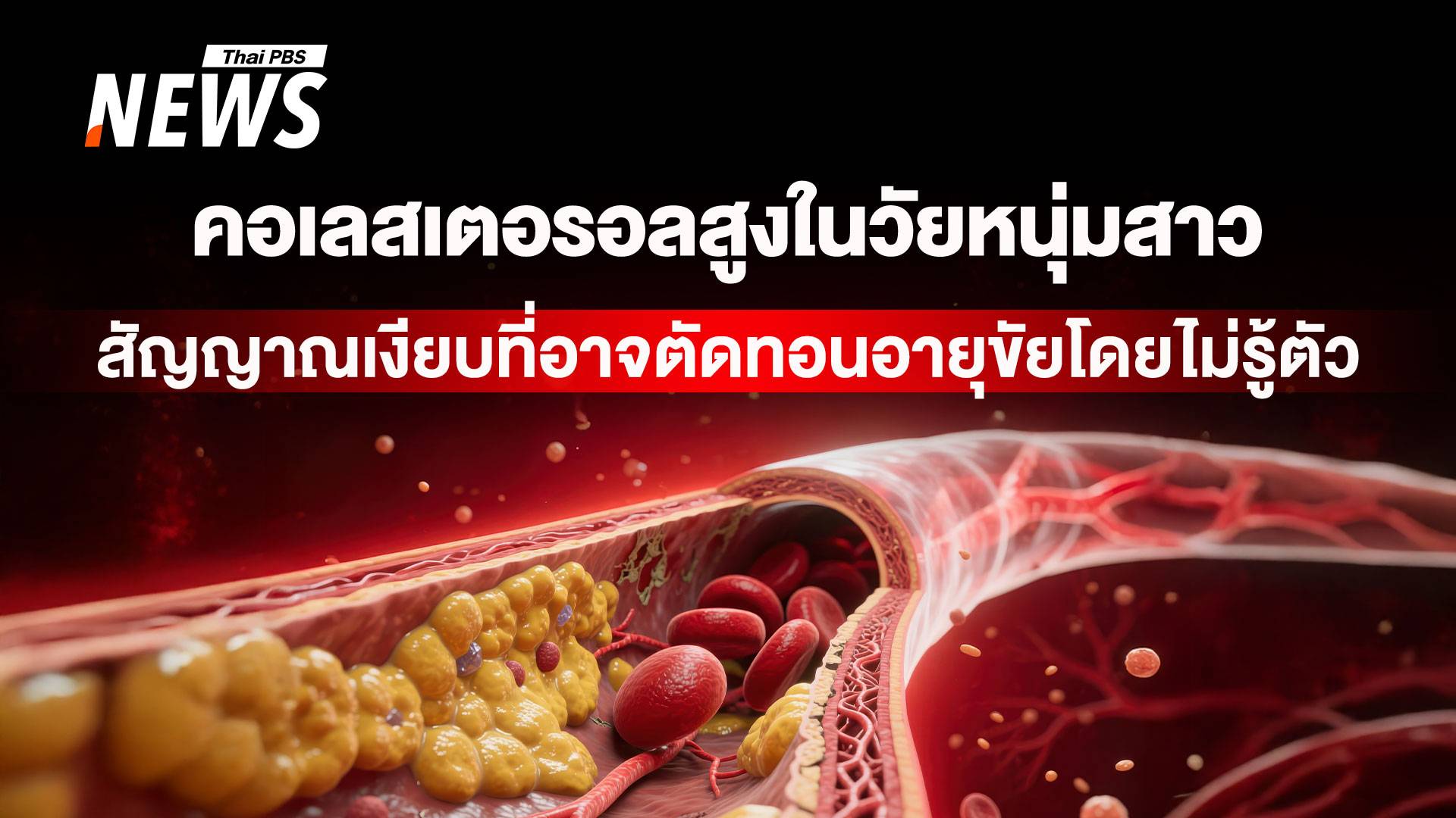 "คอเลสเตอรอลสูง" เมื่อโรคหัวใจเริ่มต้นก่อนวัย ทางรอดอาจอยู่ใน "ยีน"