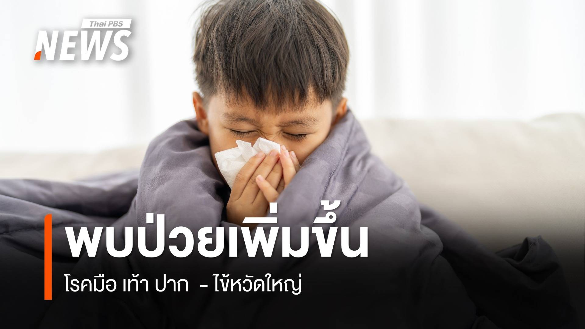 เตือน "โรคมือ เท้า ปาก - ไข้หวัดใหญ่" พบแนวโน้มสูงขึ้น   