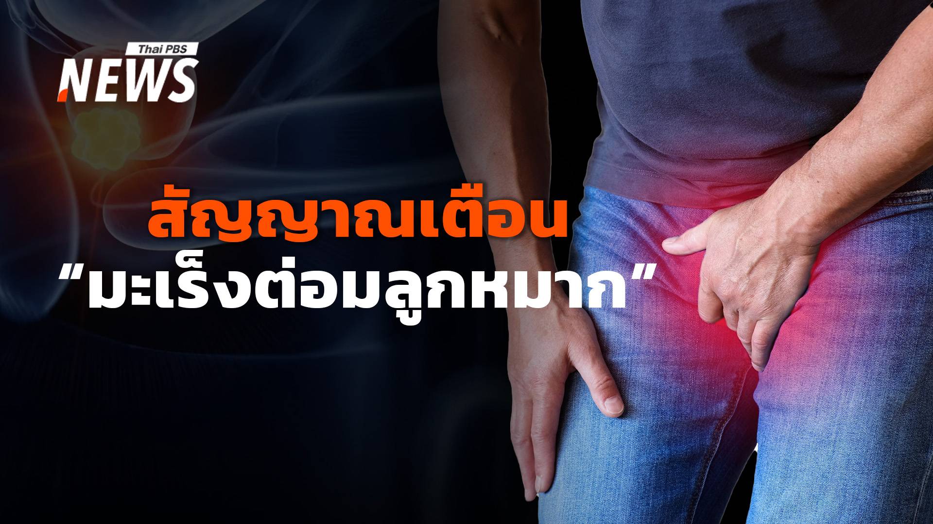 เช็กสัญญาณเตือน "มะเร็งต่อมลูกหมาก" อีกหนึ่งโรคมะเร็งที่พบมากในผู้ชาย 