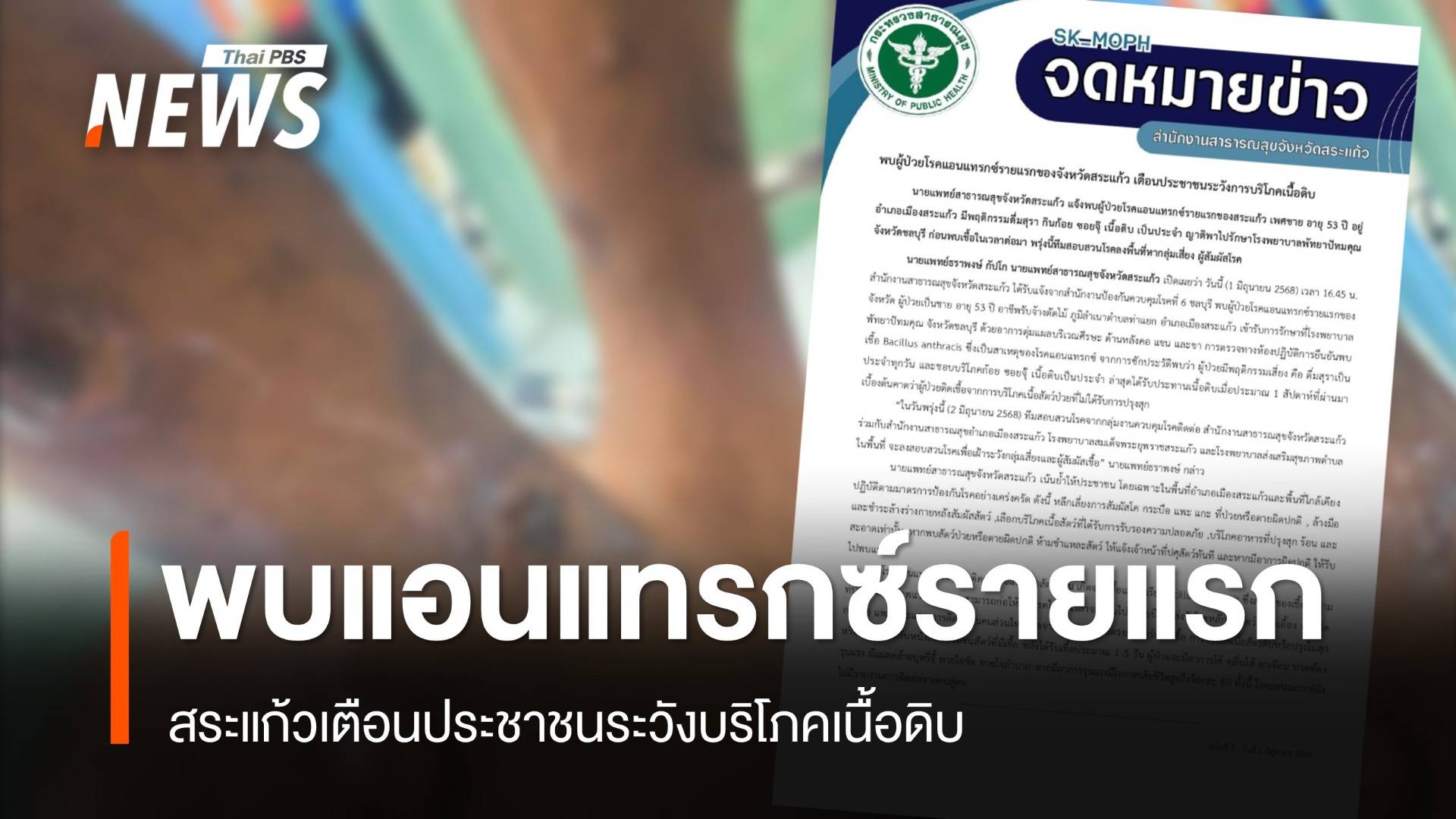 สระแก้วพบผู้ป่วยแอนแทรกซ์รายแรก ซักประวัติกินเนื้อดิบประจำ