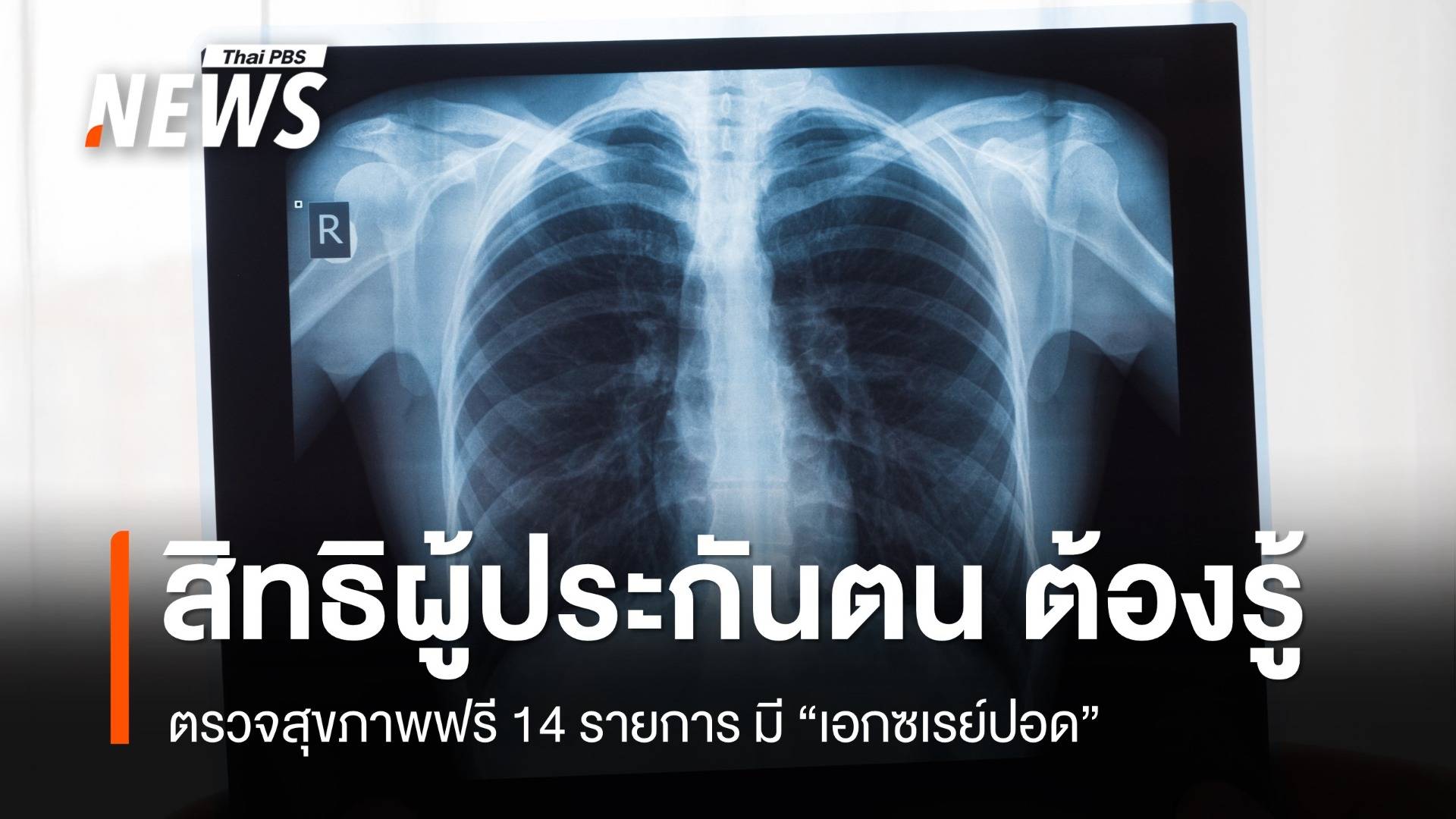 รู้สิทธิ ผู้ประกันตน ม.33, 39 ตรวจสุขภาพฟรี 14 รายการ รวมถึง "เอกซเรย์ปอด" 
