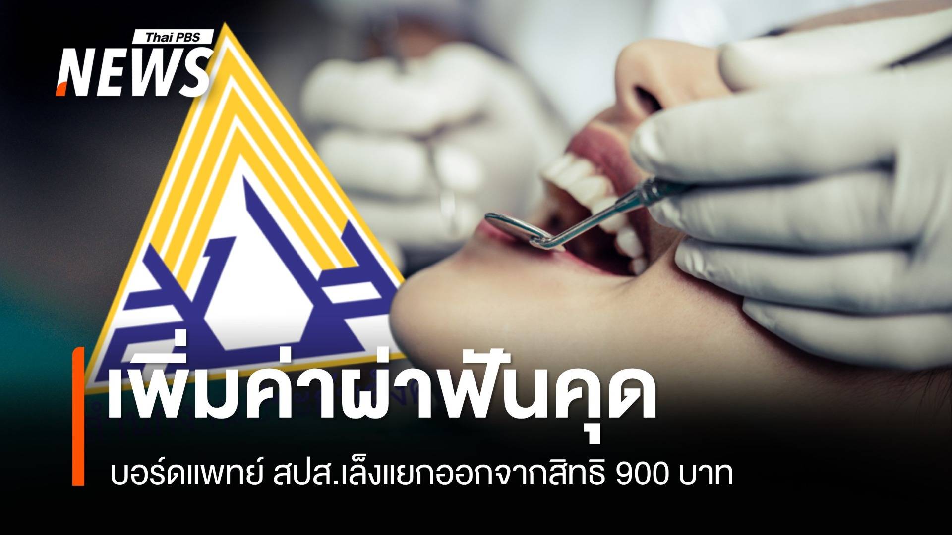 บอร์ดแพทย์ สปส.เคาะเพิ่มค่าผ่าฟันคุด ให้ผู้ประกันตน 