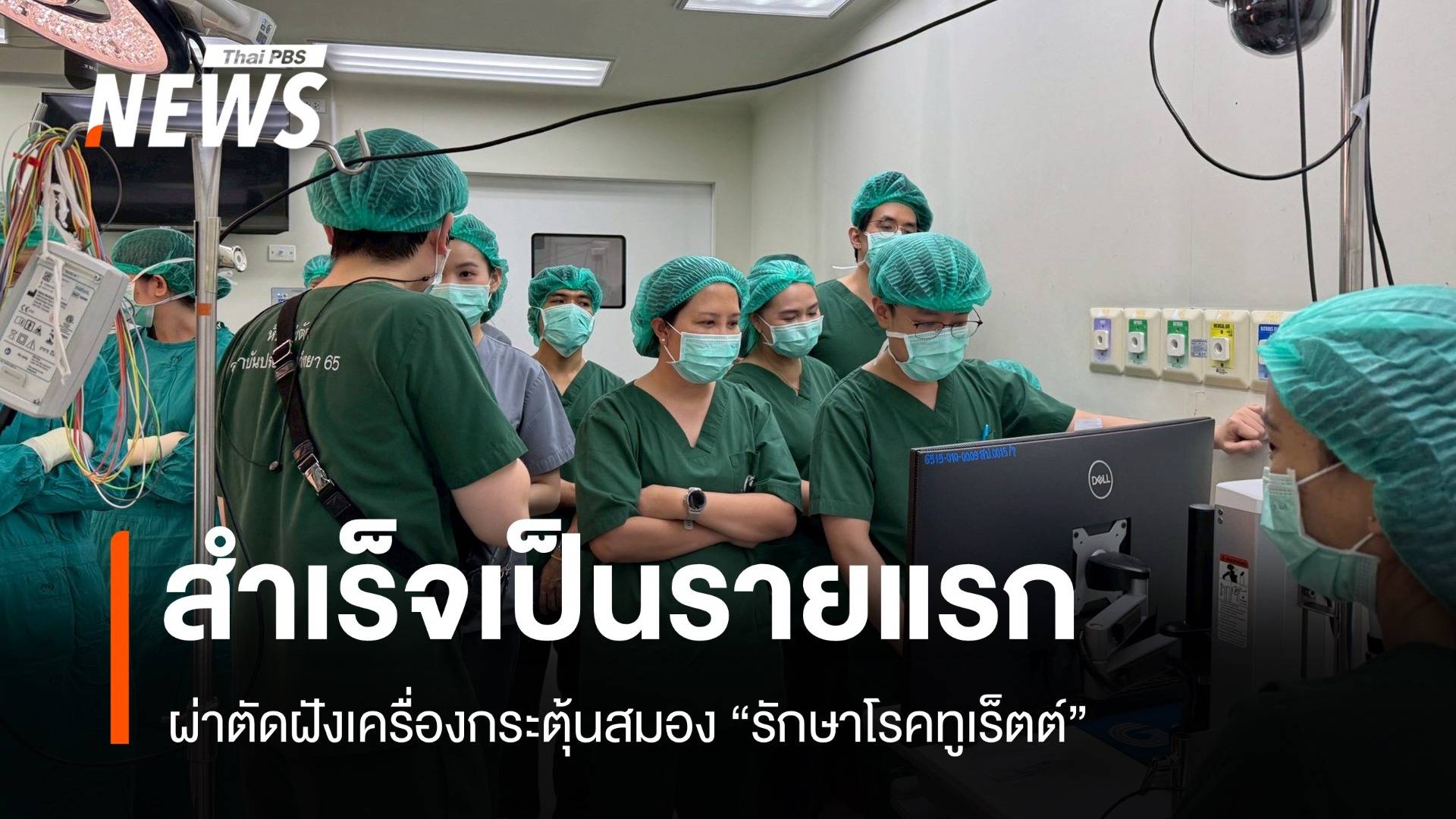 ผ่าตัดฝังเครื่องกระตุ้นสมอง "รักษาโรคทูเร็ตต์" สำเร็จรายแรก