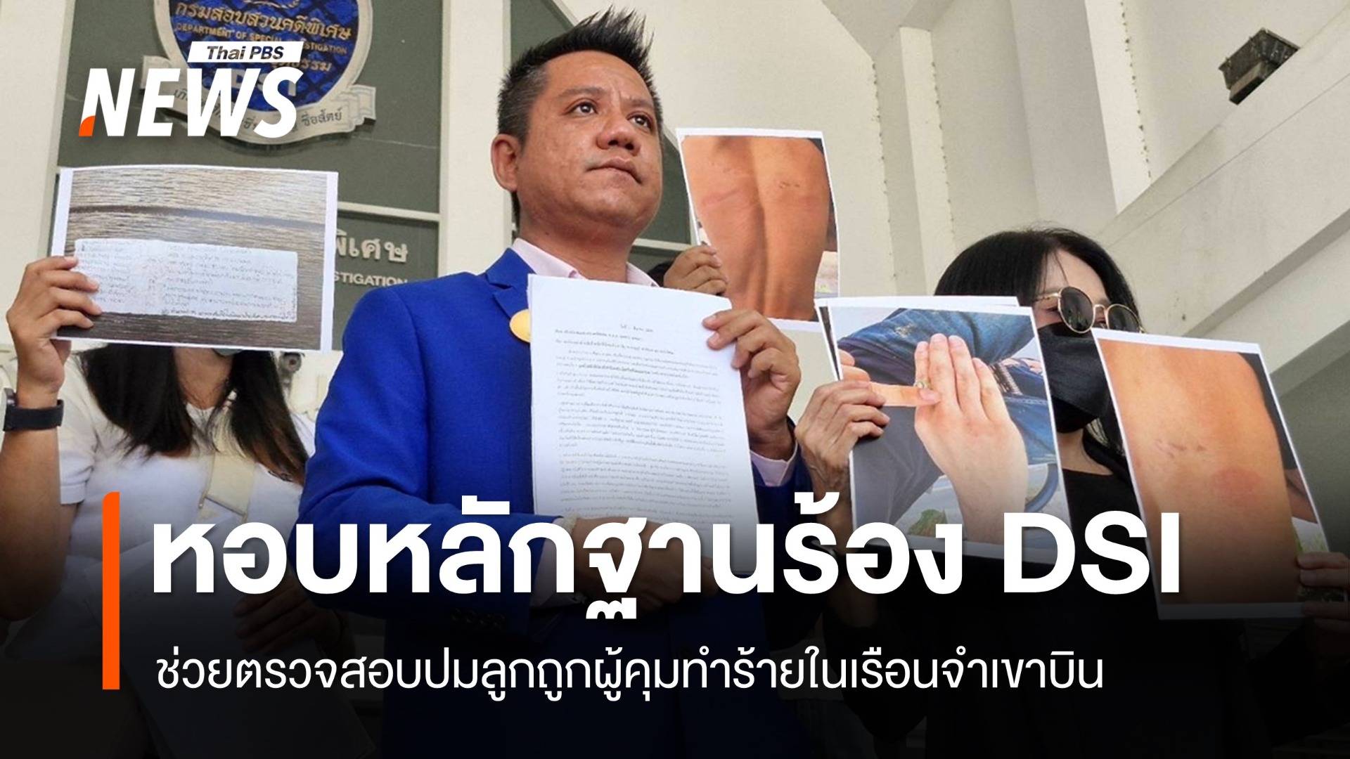 แม่ร้อง DSI ตรวจสอบปมลูกถูกผู้คุมทำร้ายในเรือนจำกลางเขาบิน