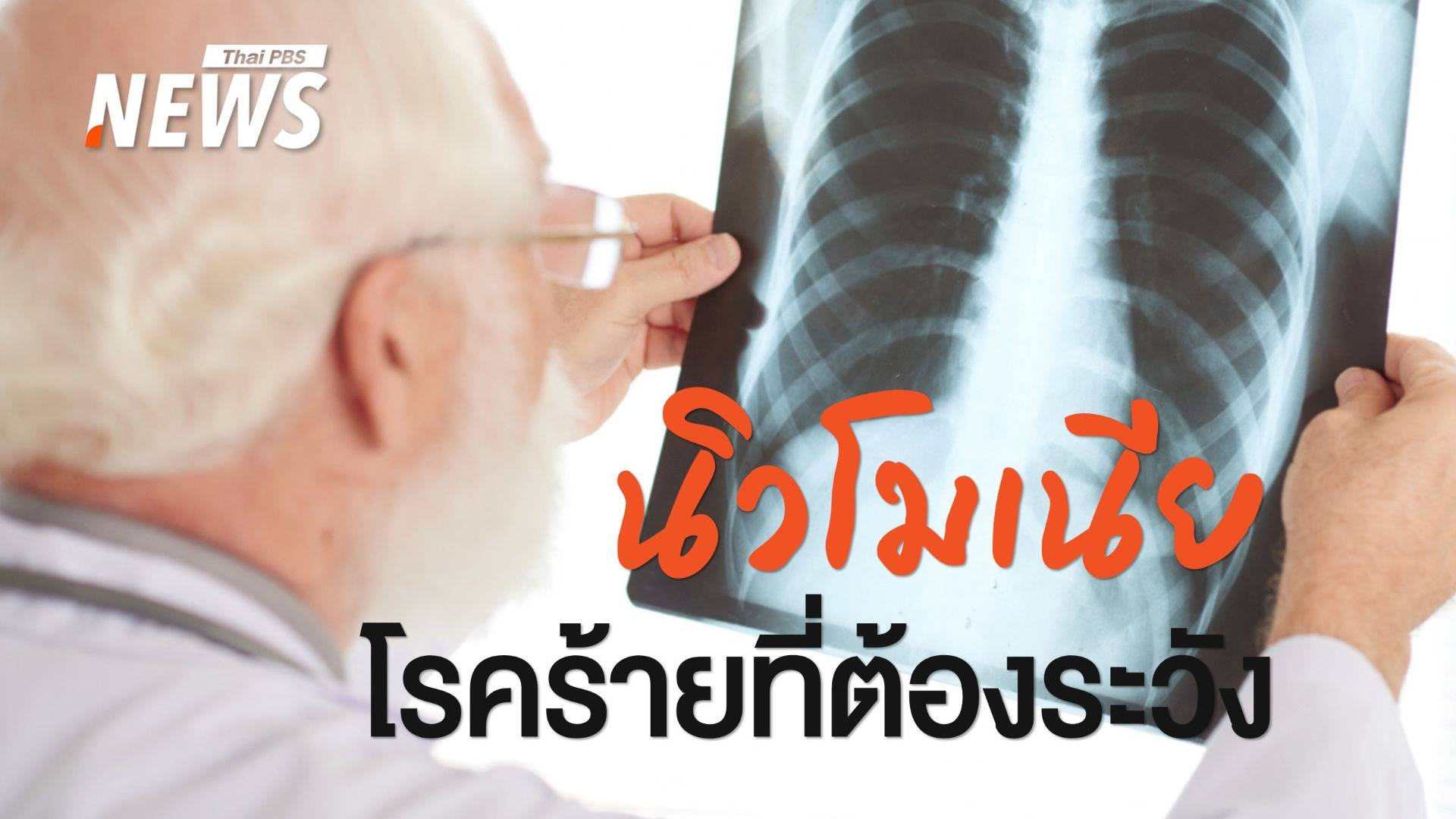 ภัยเงียบ! "นิวโมเนีย" โรคร้ายพรากชีวิต "โป๊ปฟรานซิส"