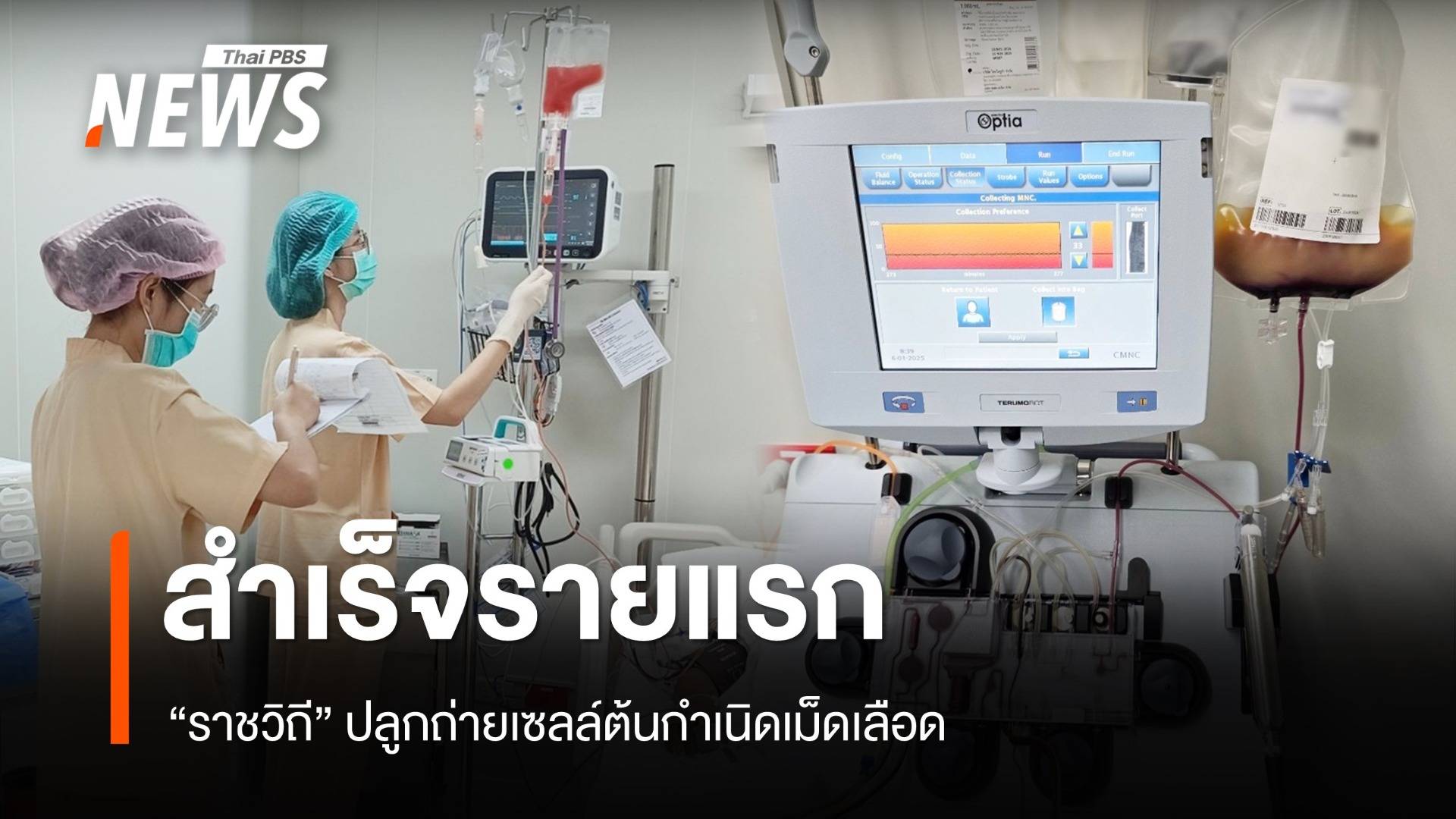 "ราชวิถี" ปลูกถ่ายเซลล์ต้นกำเนิดเม็ดเลือด สำเร็จเป็นรายแรก