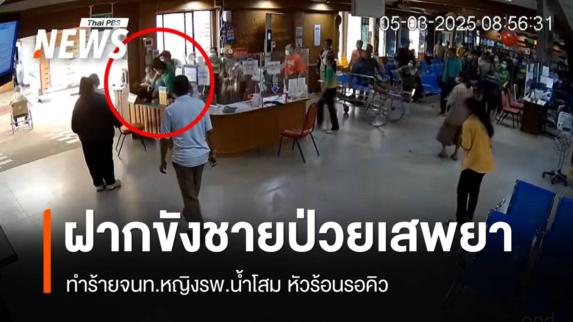 ส่งฟ้องศาลชายป่วยจิตเวช "ตบหน้า" จนท.โรงพยาบาล