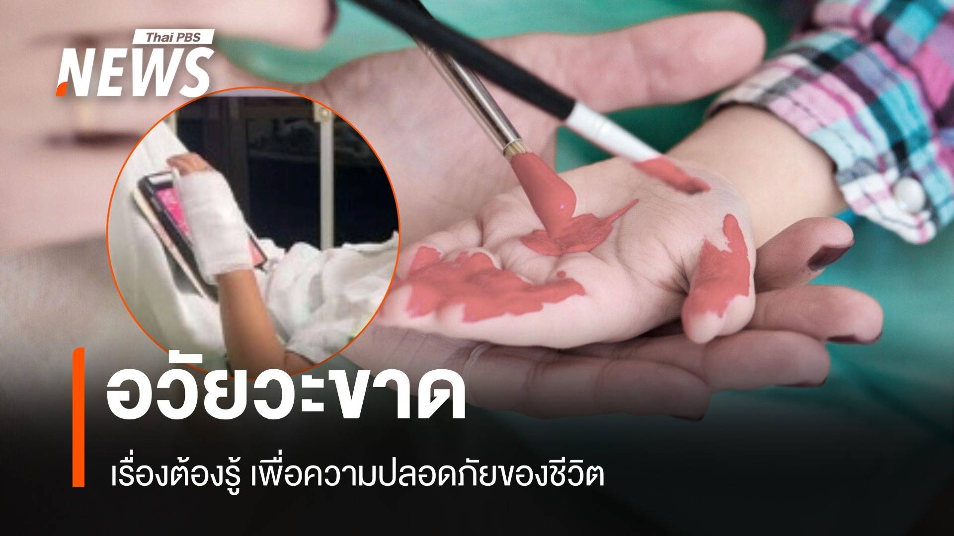 "อวัยวะขาด" เรื่องที่ต้องรู้! เพื่อความปลอดภัยของทุกชีวิต