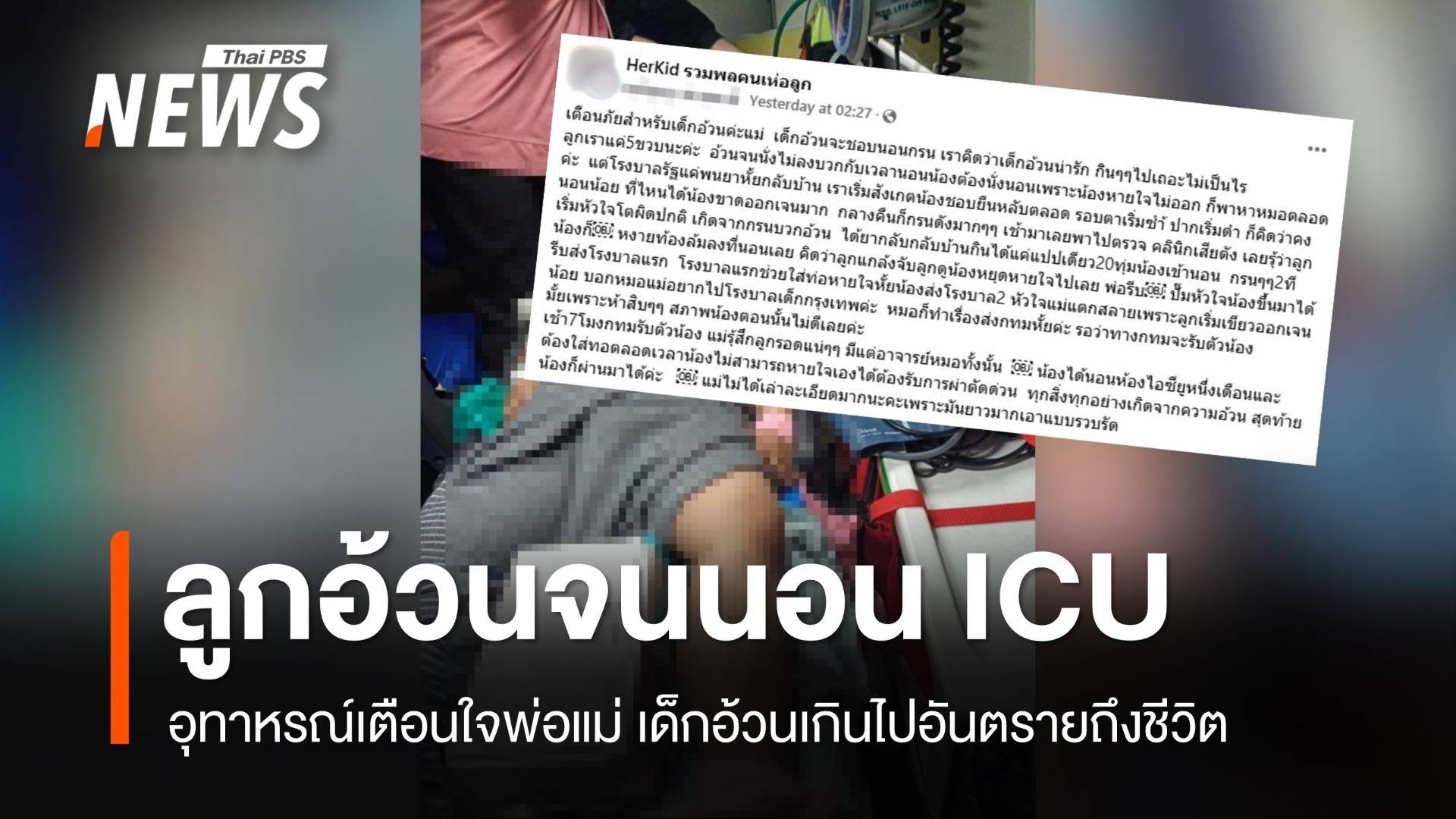 อุทาหรณ์! แม่แชร์ประสบการณ์ลูก 5 ขวบนอน ICU เพราะอ้วนเกิน