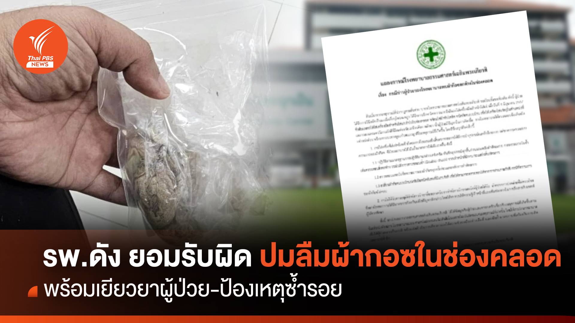 รพ.ธรรมศาสตร์ ยอมรับผิดปมลืมผ้ากอซในช่องคลอด