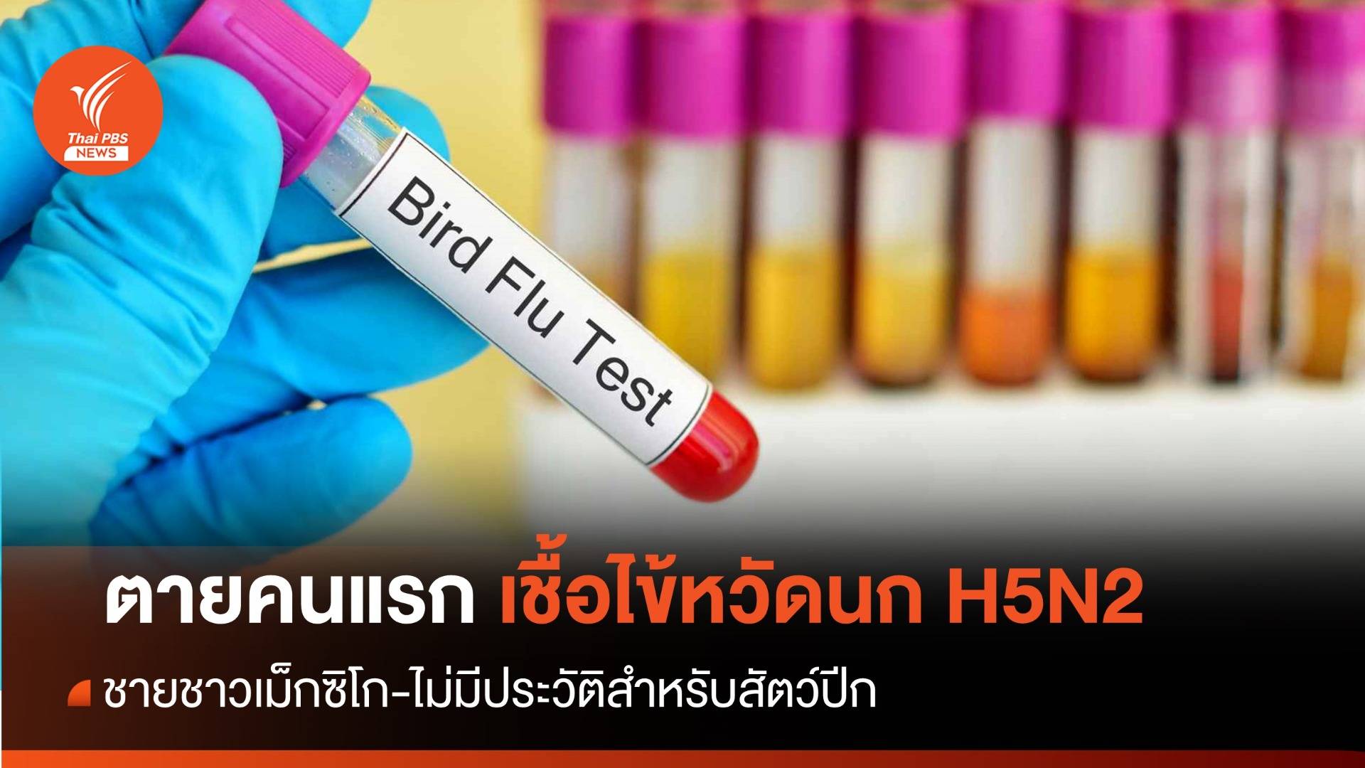 WHO ยืนยันตายคนแรกของโลกจากเชื้อไข้หวัดนก "H5N2" 