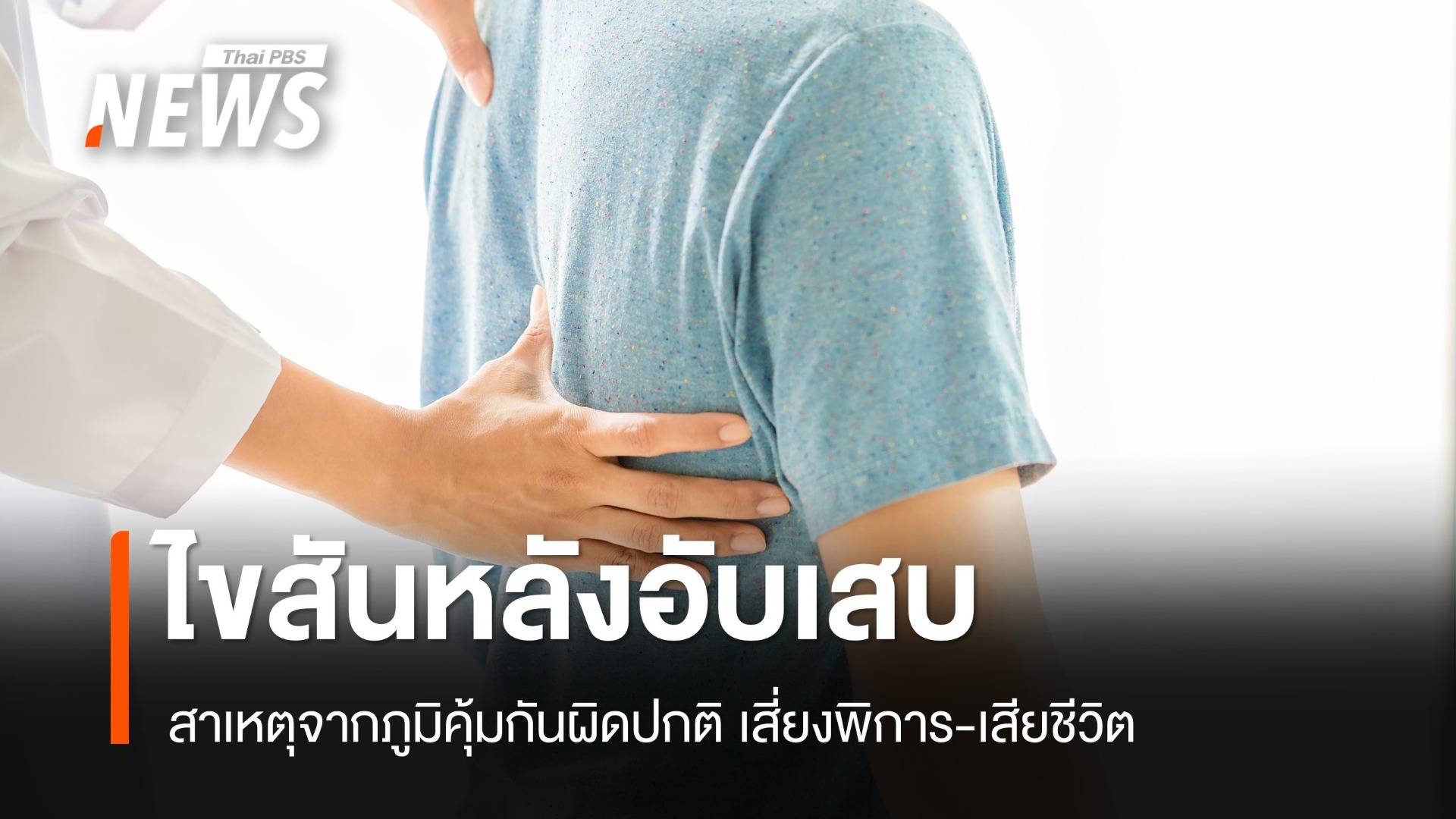 "ไขสันหลังอักเสบ" เกิดจากภูมิคุ้มกันผิดปกติเสี่ยงพิการ เสียชีวิต