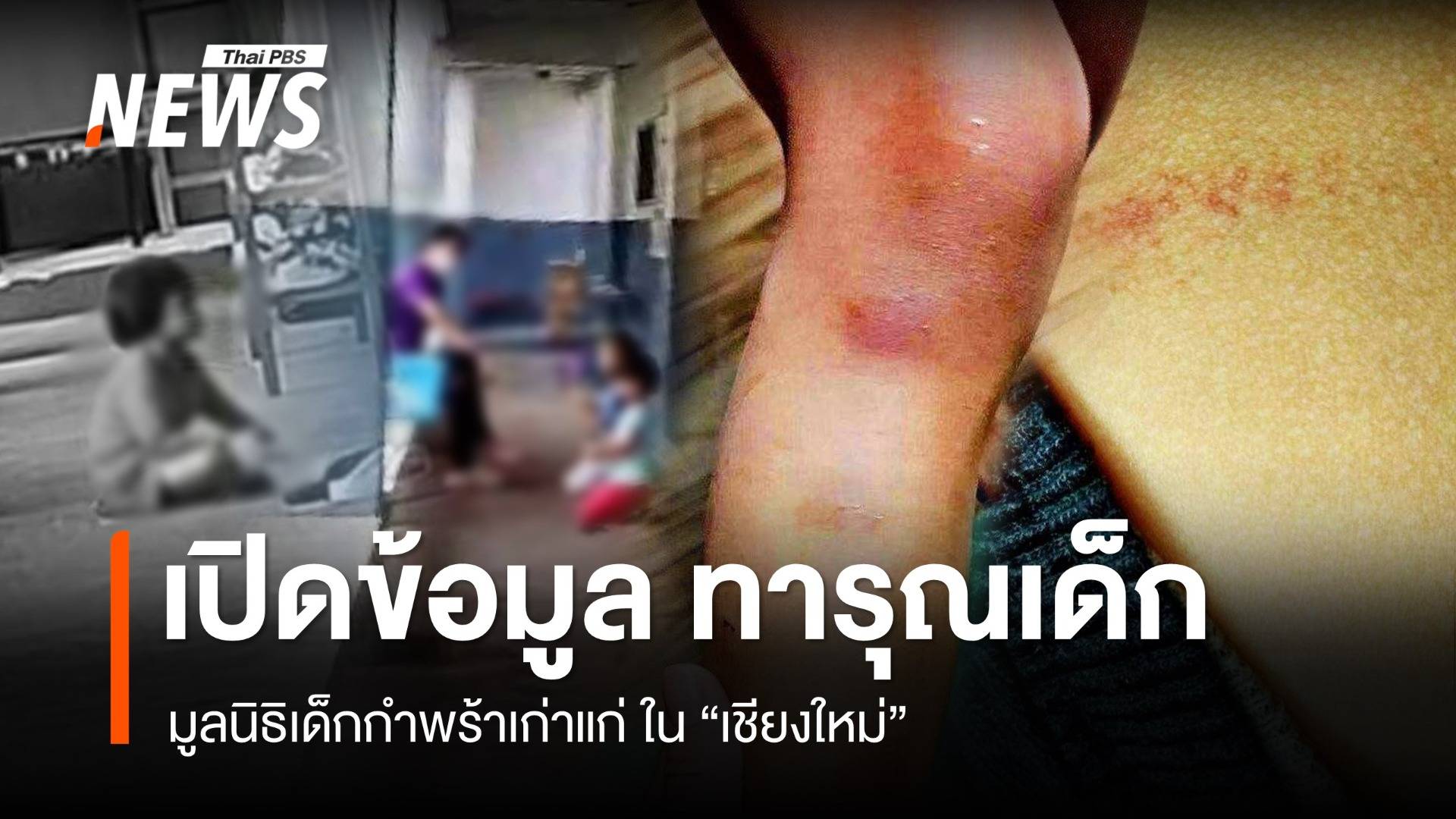 เปิดข้อมูล มูลนิธิเด็กกำพร้าเก่าแก่ ใน จ.เชียงใหม่  "ทารุณกรรมเด็ก"  