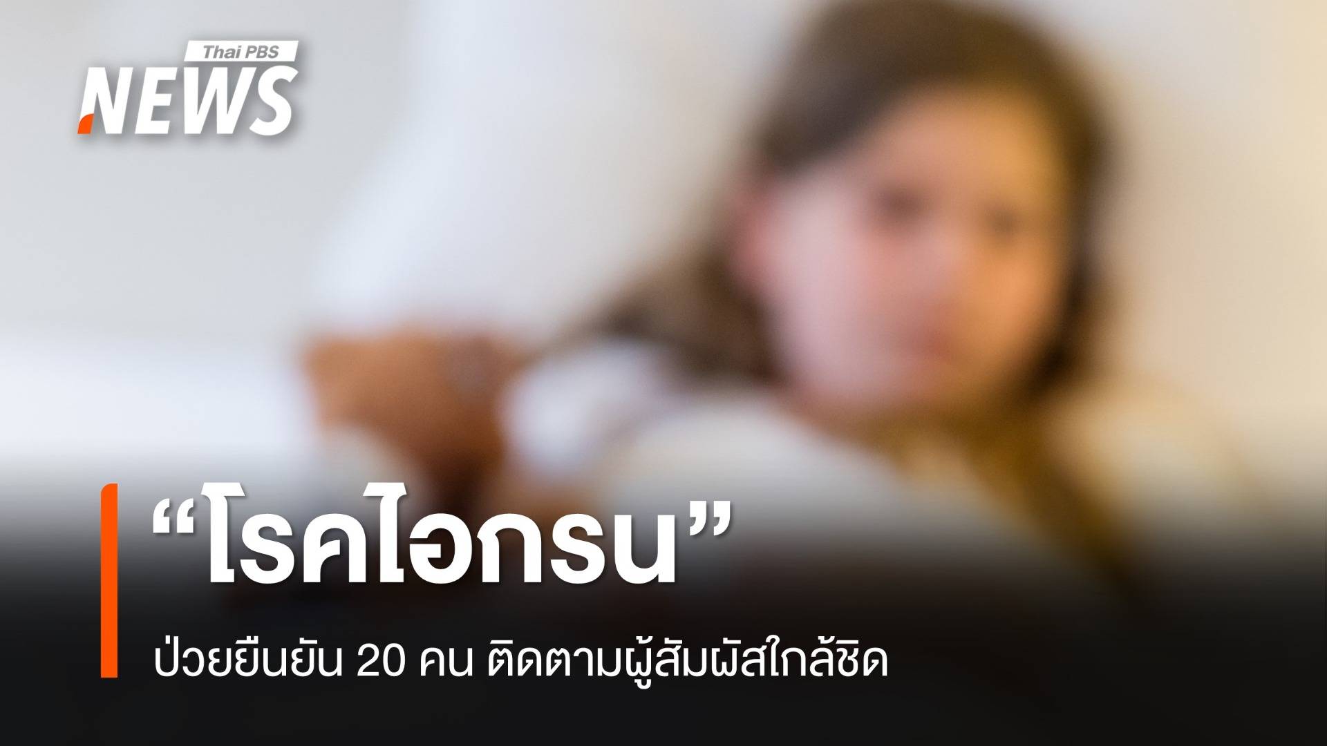 "โรคไอกรน" ป่วยยืนยัน 20 คน ติดตามผู้สัมผัสใกล้ชิด