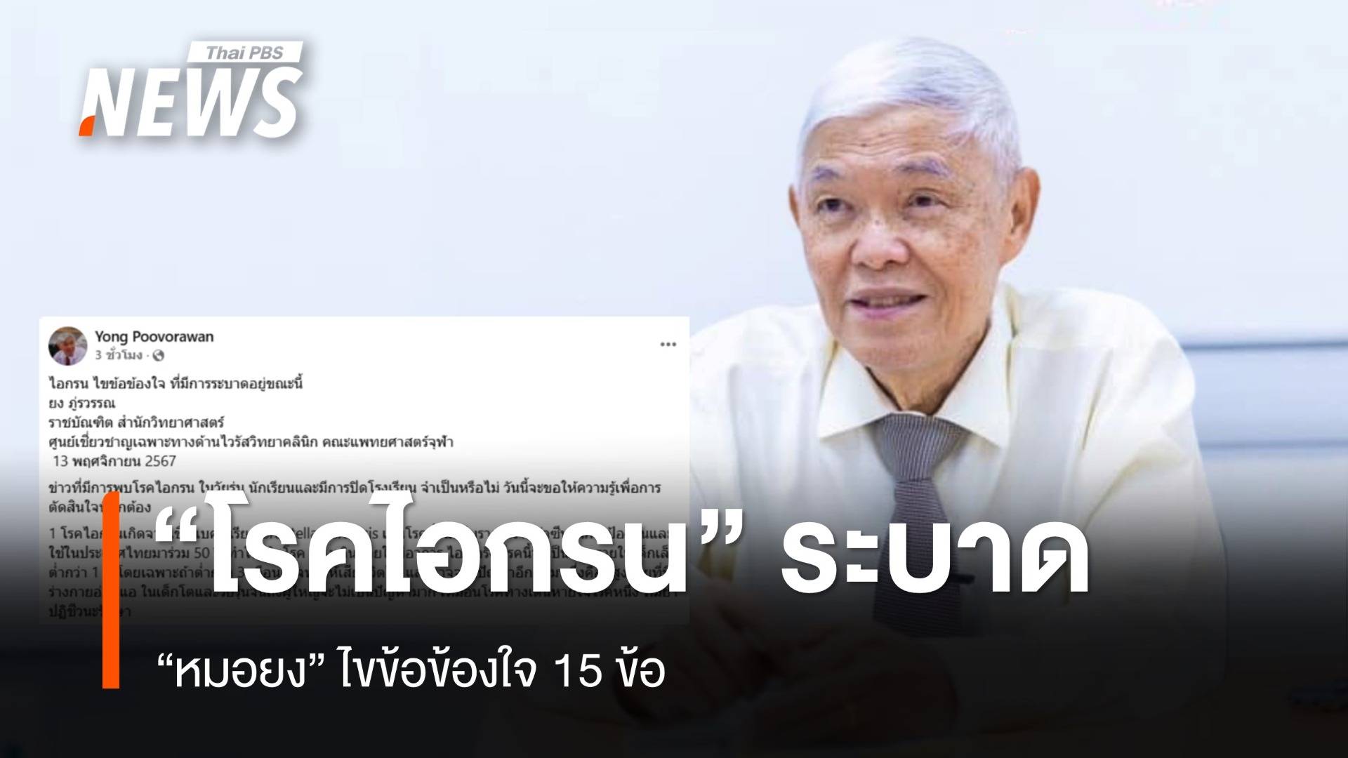 "หมอยง" ไขข้อข้องใจ 15 ข้อ "โรคไอกรน" แนะฉีดวัคซีนป้องกัน