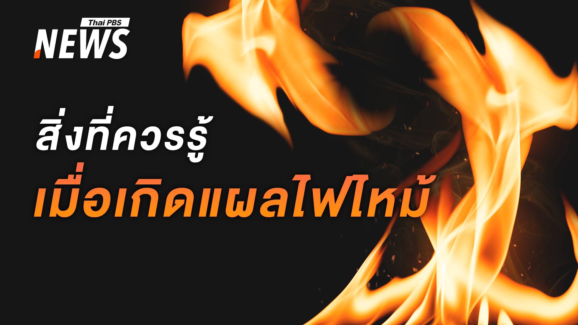 สิ่งที่ควรรู้ เมื่อเกิดแผลไฟไหม้ เช็กระดับรุนแรงแค่ไหน