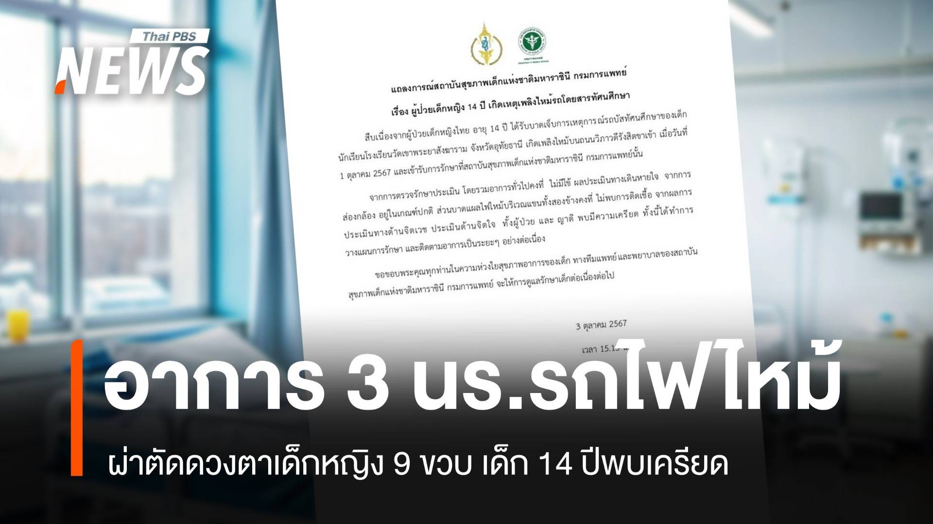 อัปเดตเด็ก 9 ปี รถบัสไฟไหม้ ผ่าตัดดวงตา-อาการบวมไฟลด
