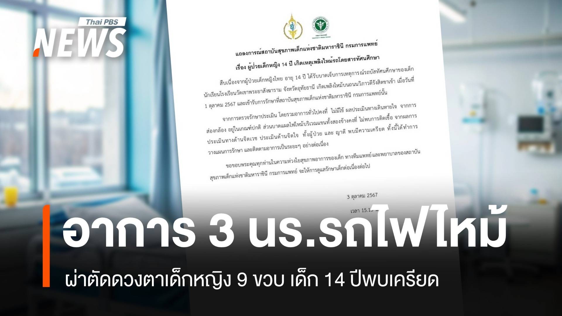 อัปเดตเด็ก 9 ปี รถบัสไฟไหม้ ผ่าตัดดวงตา-อาการบวมไฟลด  