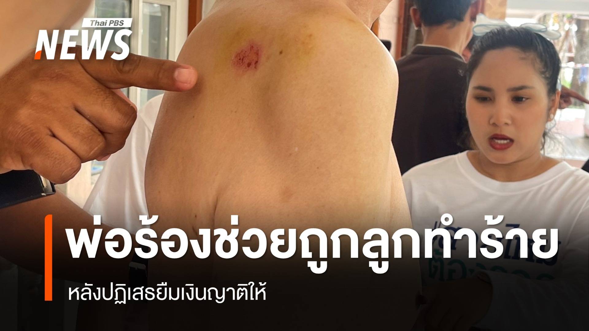 พ่อร้องช่วยถูกลูกทำร้าย หลังปฏิเสธไปยืมเงินญาติให้