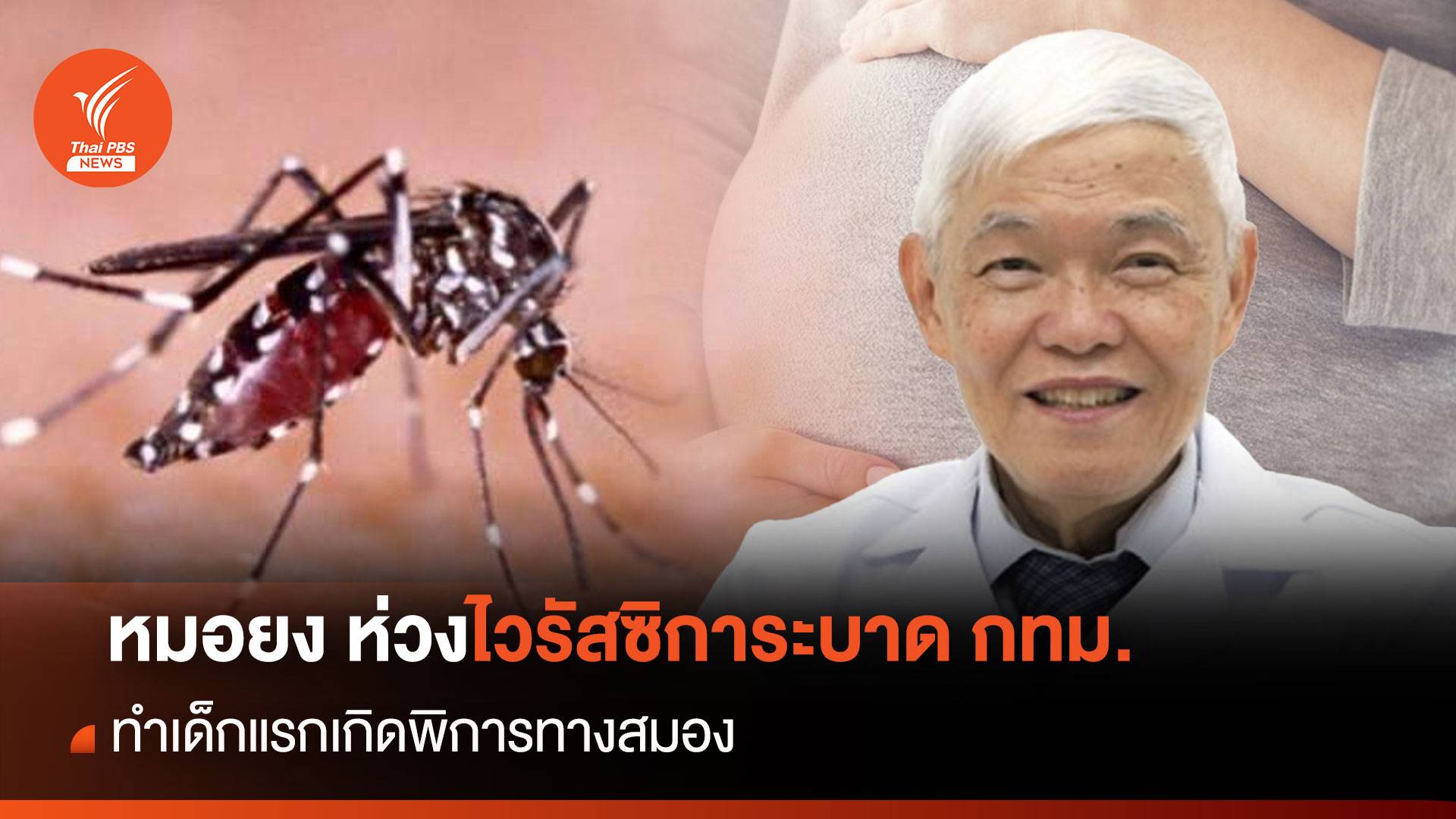 "หมอยง" ห่วงไวรัสซิการะบาดกทม. ทำเด็กแรกเกิดพิการทางสมอง