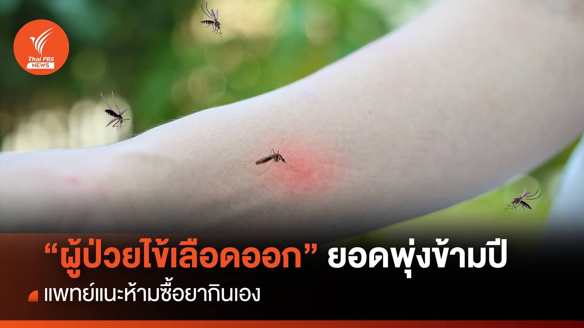 "ผู้ป่วยไข้เลือดออก" ยอดพุ่งข้ามปี แพทย์แนะห้ามซื้อยากินเอง