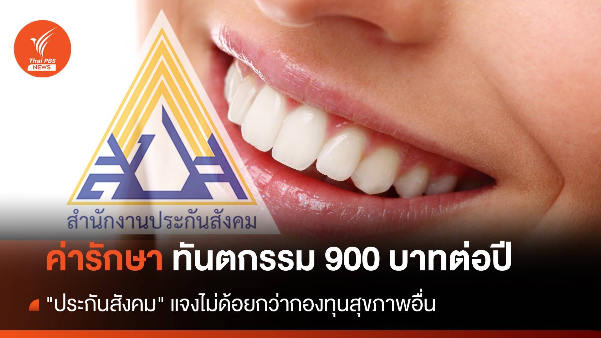 "ประกันสังคม" แจงชัดค่ารักษาทันตกรรม 900 บาทต่อปี ไม่ด้อยกว่ากองทุนสุขภาพอื่น