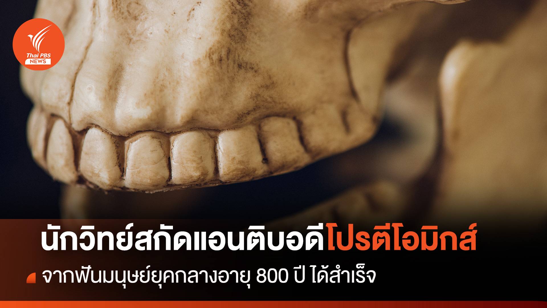 นักวิทย์สกัดแอนติบอดี จากฟันมนุษย์ยุคกลางอายุ 800 ปี ได้สำเร็จ