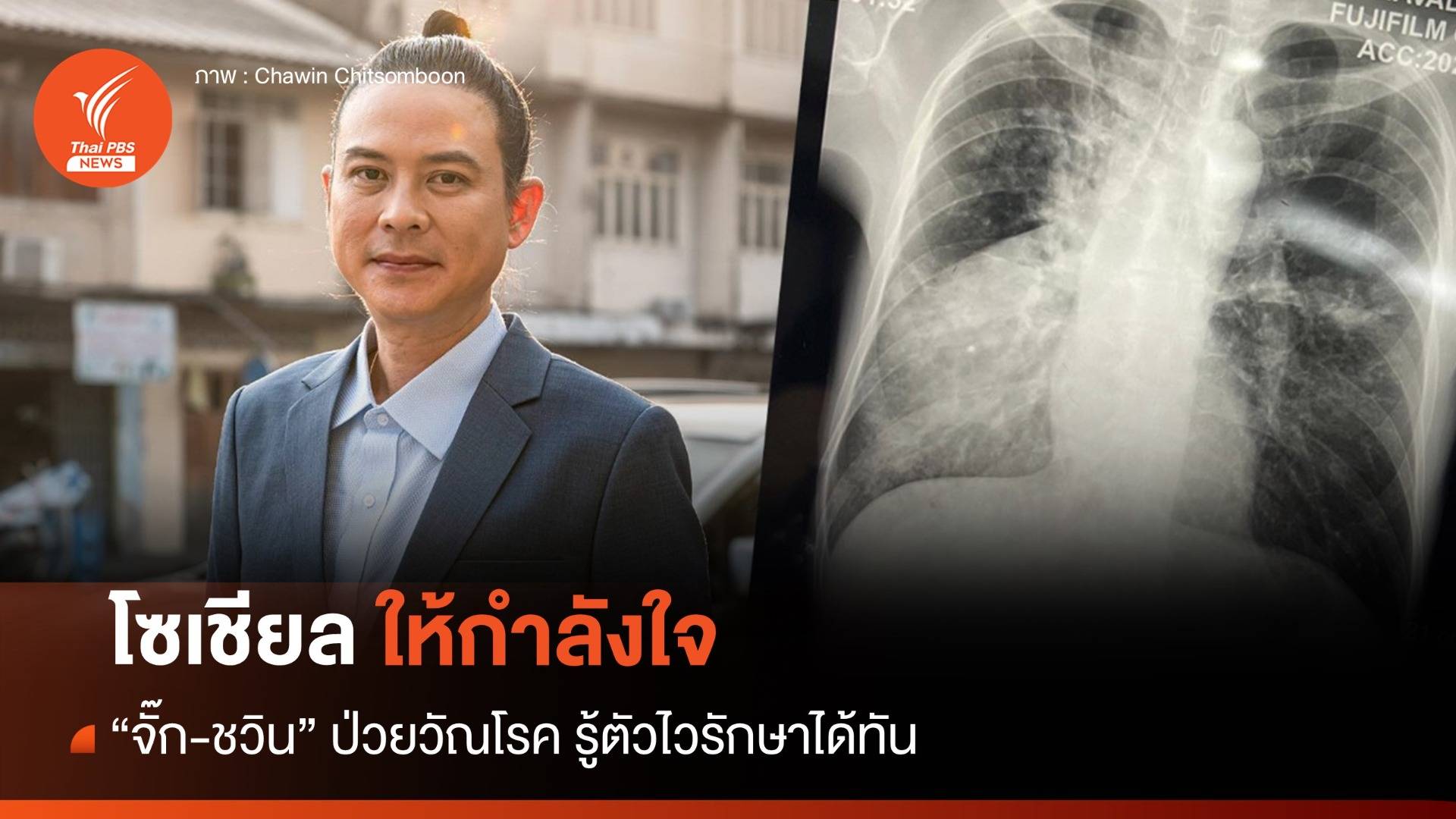 วัณโรคทำ "จั๊ก-ชวิน" ยกเลิกงาน แฟนเพลงแห่ให้กำลังใจ