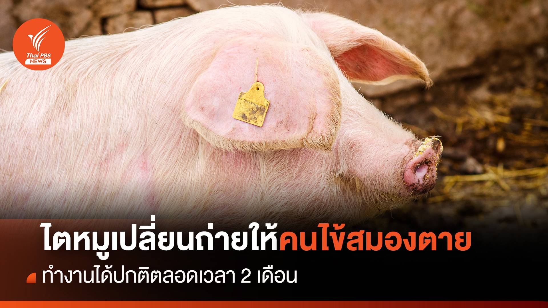 "ไตหมู" ทำงานได้ปกติตลอด 2 เดือน หลังปลูกถ่ายไตให้กับคนไข้สมองตาย