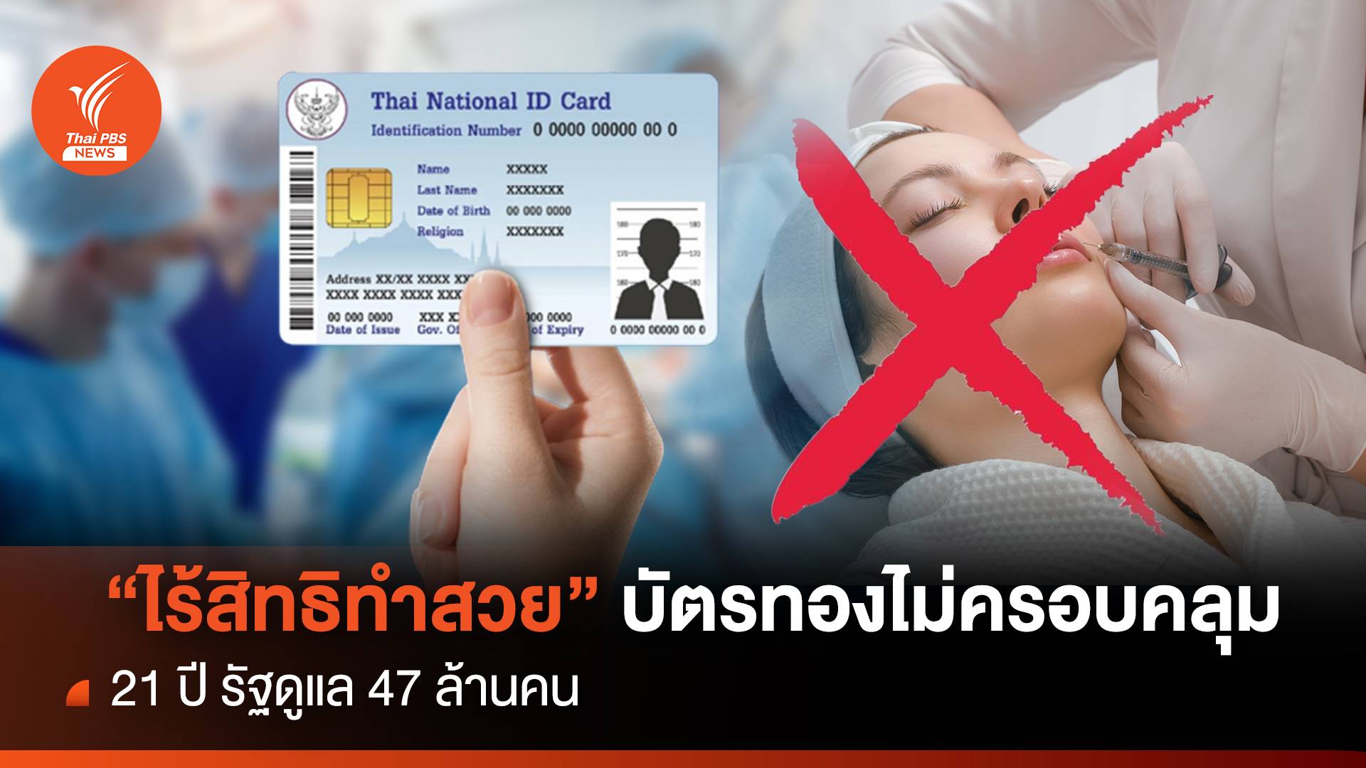 "ไร้สิทธิทำสวย" บัตรทองไม่ครอบคลุม